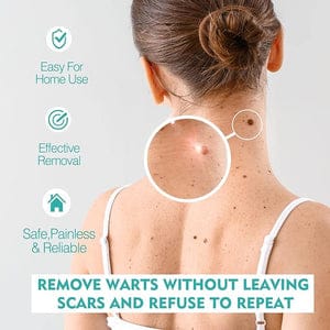 West & Month - Skin Tag Remover